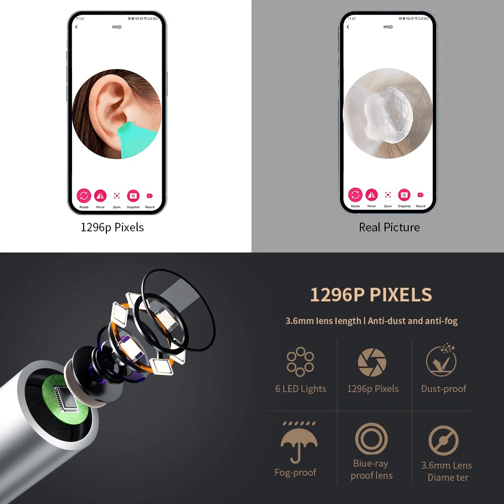 Wireless Smart Visual Ear Cleaner – 1296P HD Camera & LED Lights
