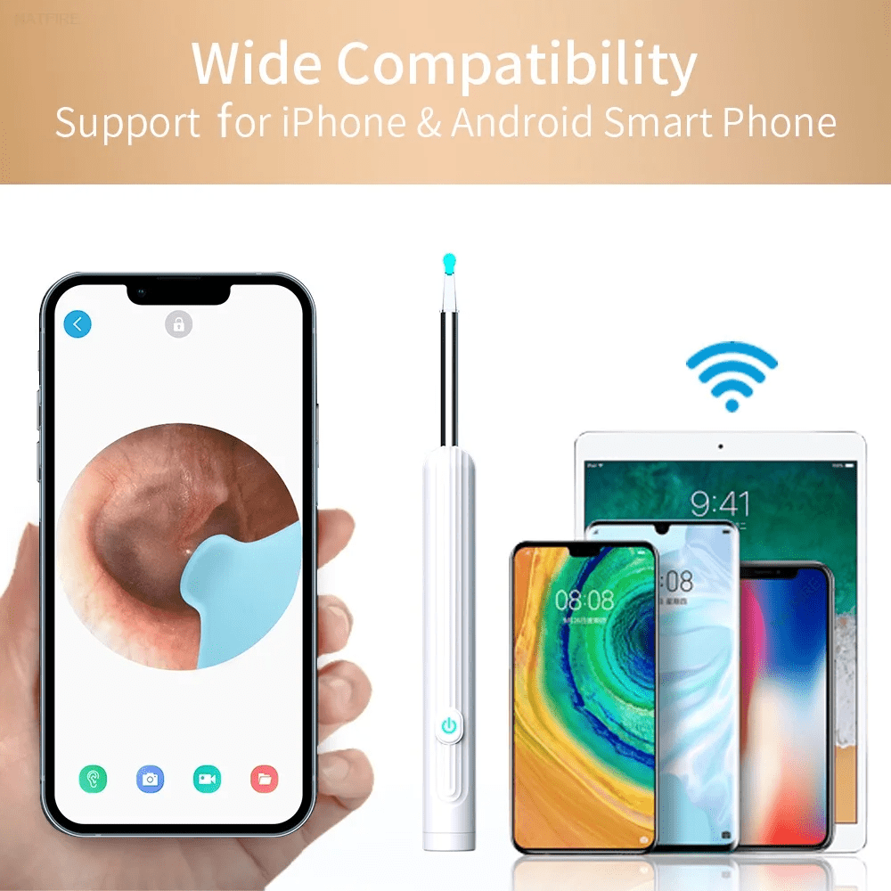 Wireless Smart Visual Ear Cleaner – 1296P HD Camera & LED Lights